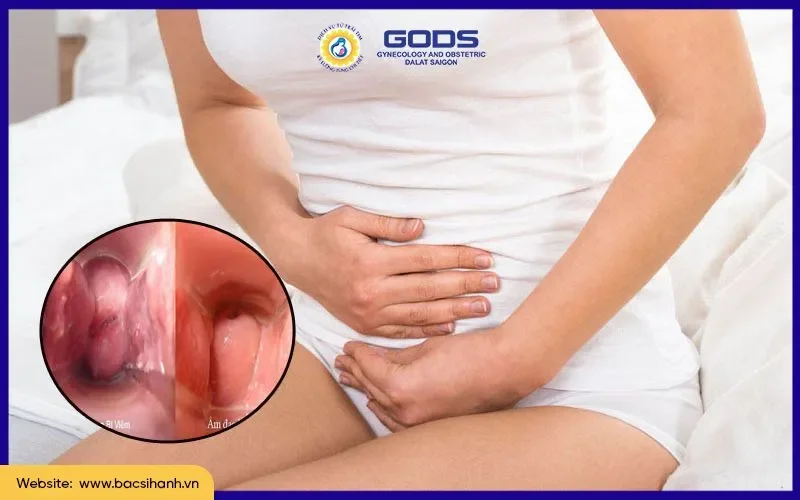 Viêm âm đạo gây ra vùng kín nổi mụn ngứa