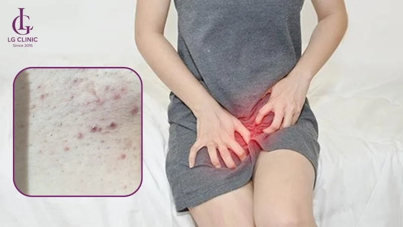 nổi mụn vì không vệ sinh đúng cách