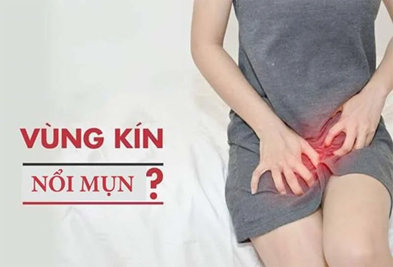 vùng kín nữ nổi mụn