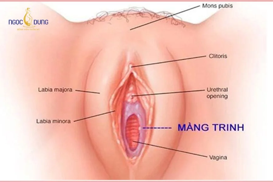 Sơ đồ giải phẫu vùng tiền đình âm đạo thể hiện chính xác vị trí và cấu trúc của màng trinh