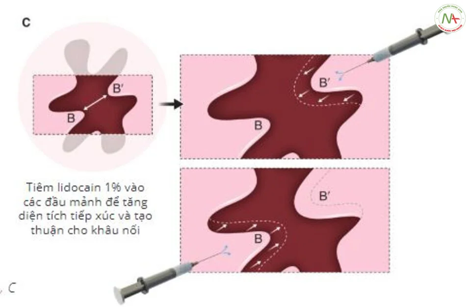 Bộ sưu tập hình ảnh màng trinh bình thường — ảnh 64