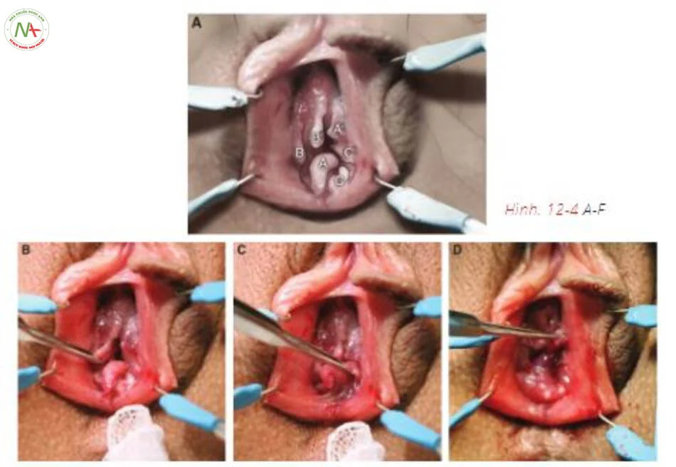 Bộ sưu tập hình ảnh màng trinh bình thường — ảnh 74