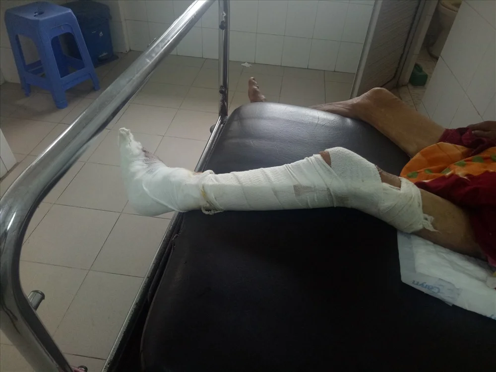 Người đàn ông nguy kịch, nằm viện không người chăm sau khi kẻ gây tai nạn bỏ trốn